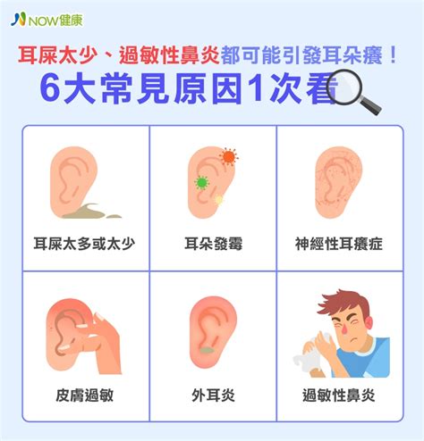 耳朵癢|耳朵癢卻沒有耳屎，是耳朵發黴？專家曝6大原因、4緩解法 